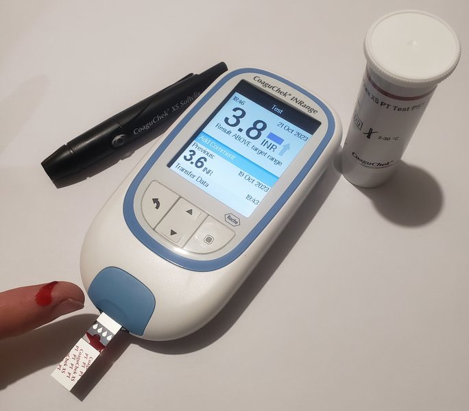 TAVI : bioprothèse percutanée