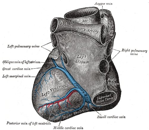 Thrombose de prothèse valvulaire