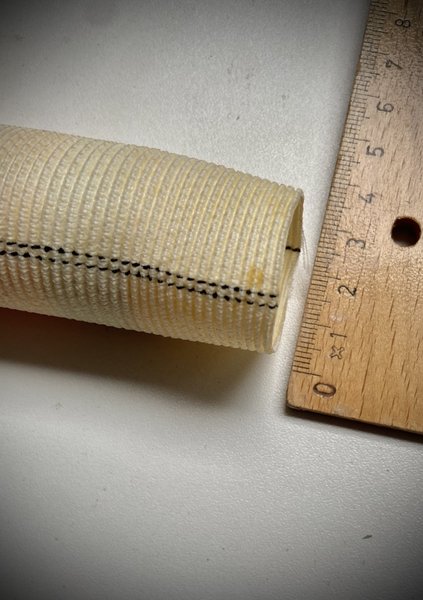 Prothèses vasculaires : types et complications