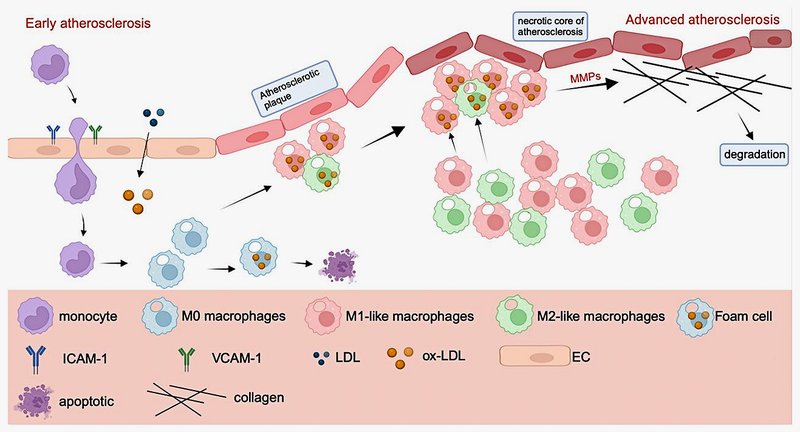 Athérogenèse : mécanismes et histologie de la plaque