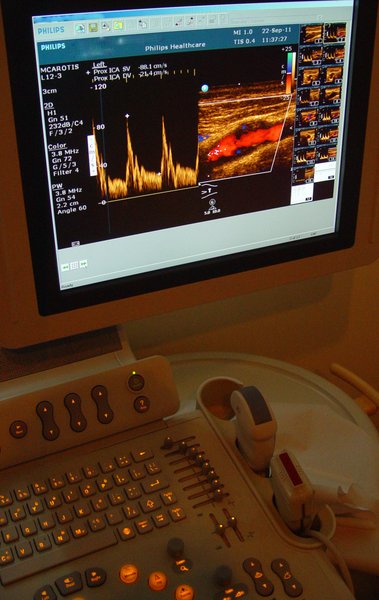 HTA : retentissement sur les organes ciblés