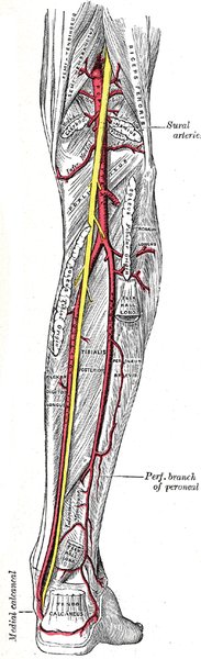 AAA : traitement (chirurgie, EVAR)