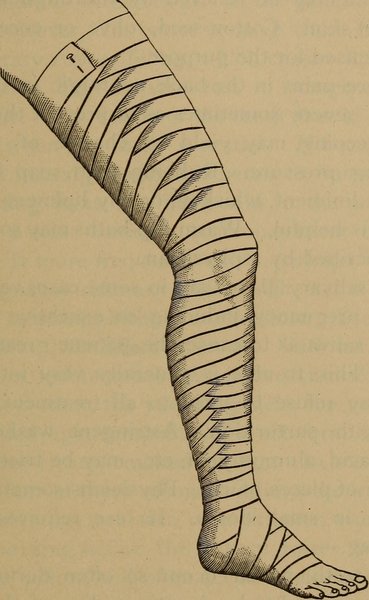 Diagnostic de l'IVC et classification CEAP
