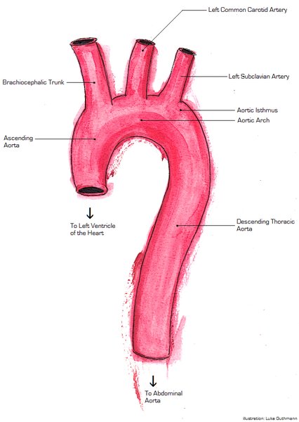 Dissection aortique : diagnostic (TDM, ETO, RP)