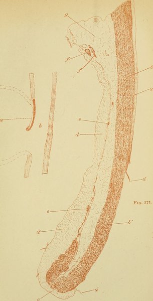 Dissection aortique : traitement