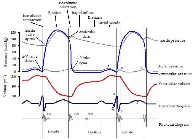 Morphologie QRS normale et pathologique