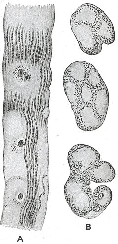 Physiopathologie de la FA