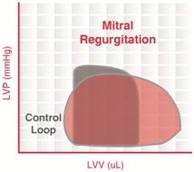 IM : diagnostic et classification Carpentier
