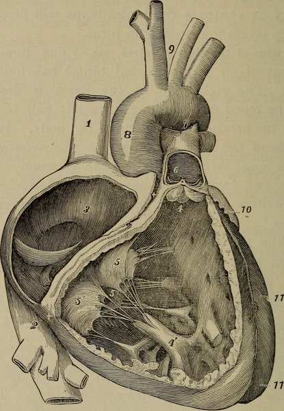 Étiologies de l'IC droite