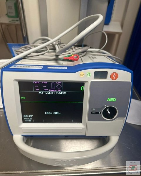 Complications aiguës IDM : troubles du rythme