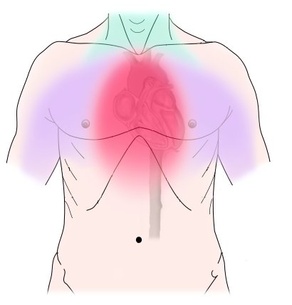 Physiopathologie et diagnostic de l'angor stable