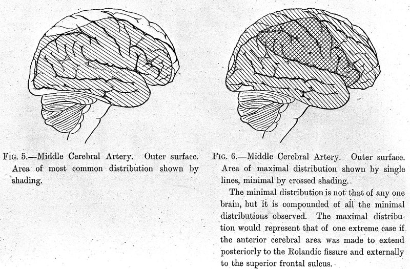 Définitions : Malaise, PDCB, Syncope, Lipothymie