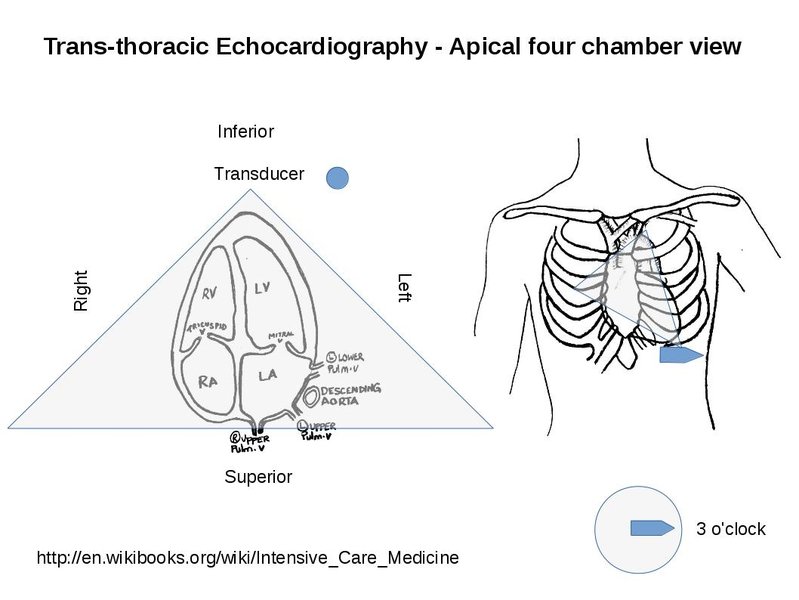 Bilan de la syncope : ETT, Holter, test d'effort