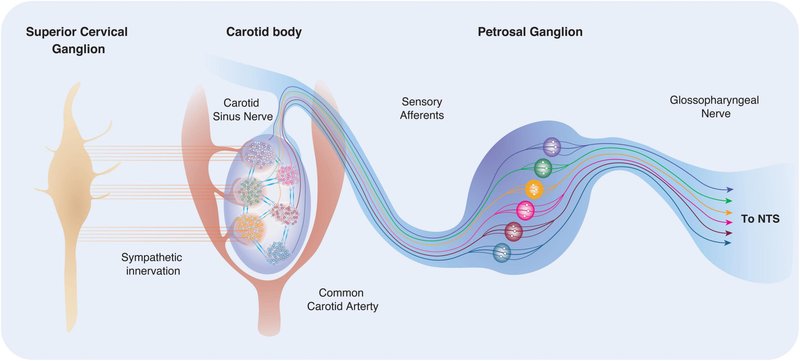 Syndrome du sinus carotidien / Holter implantable