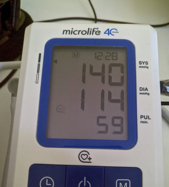 Hypotension orthostatique