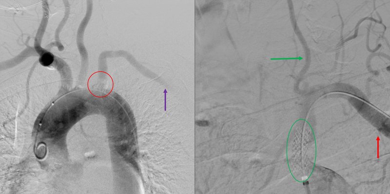 Syncope situationnelle