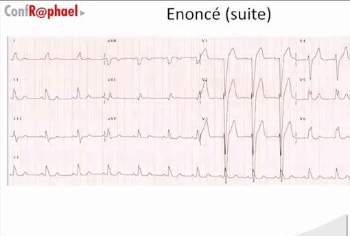 Conférence Introductive de Cardiologie