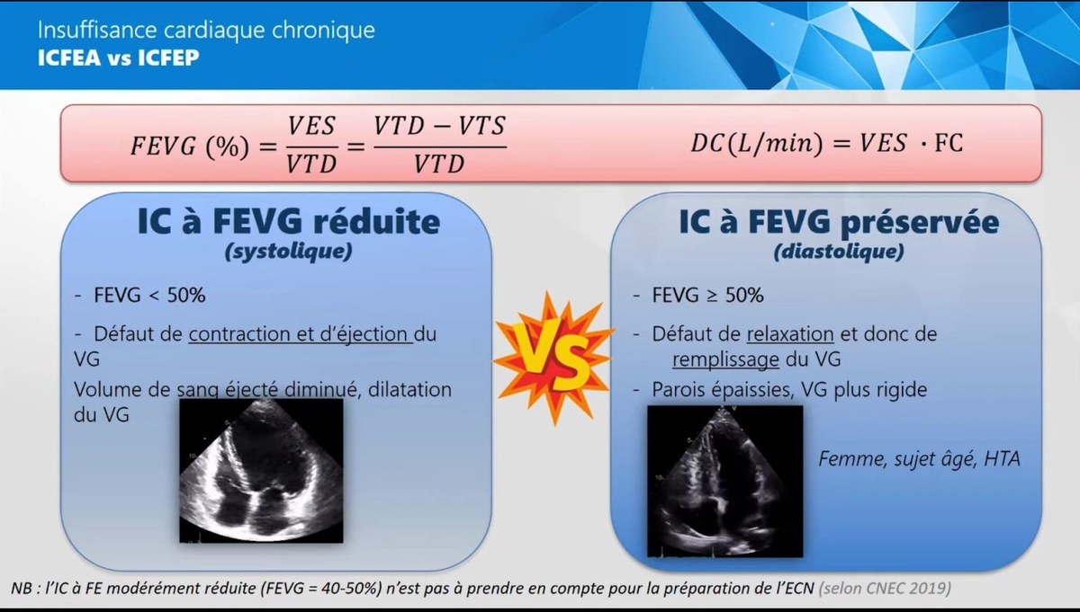 Dyspnée Aiguë et Chronique d'Origine Cardiaque