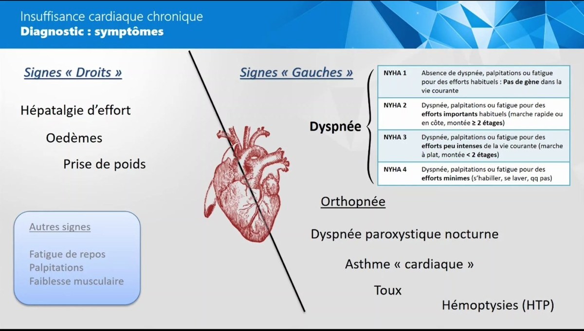 Dyspnée Aiguë et Chronique d'Origine Cardiaque