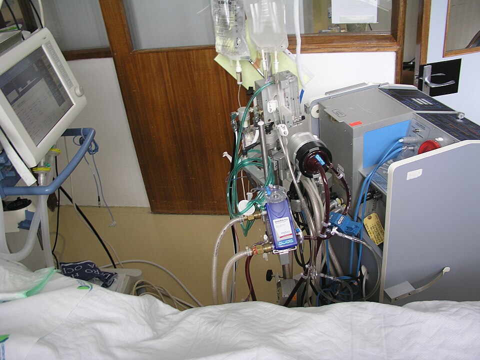ECMO