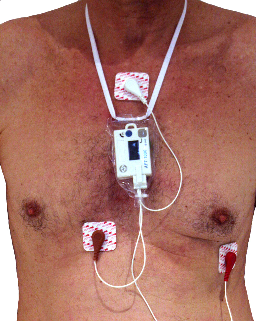 Holter ECG (enregistrement ambulatoire)