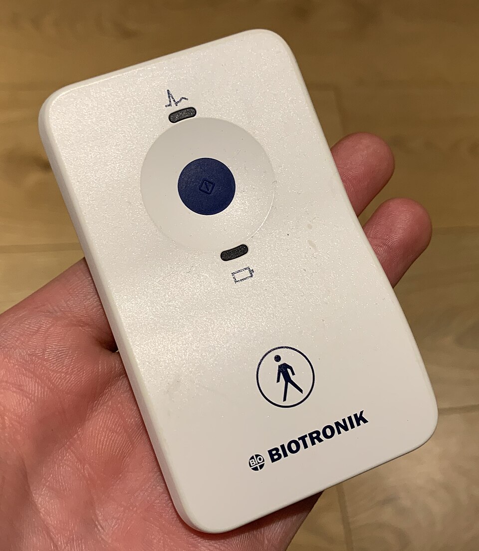 Holter implantable (loop recorder)