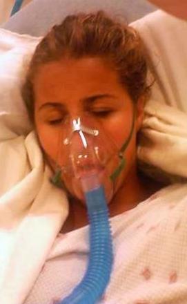 Ventilation non invasive (VNI)