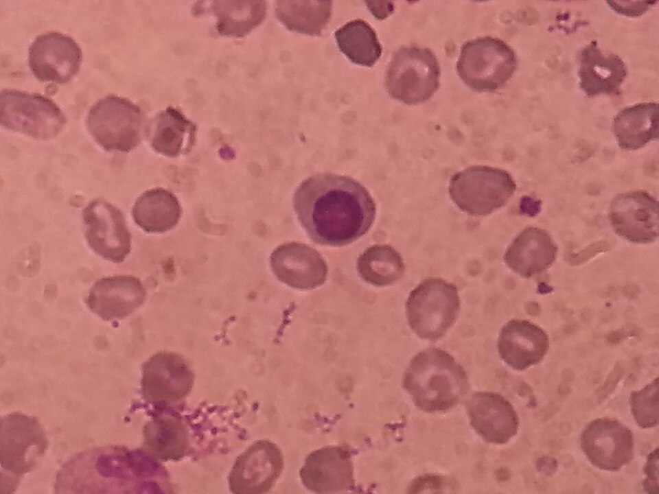 Le sang vu au microscope