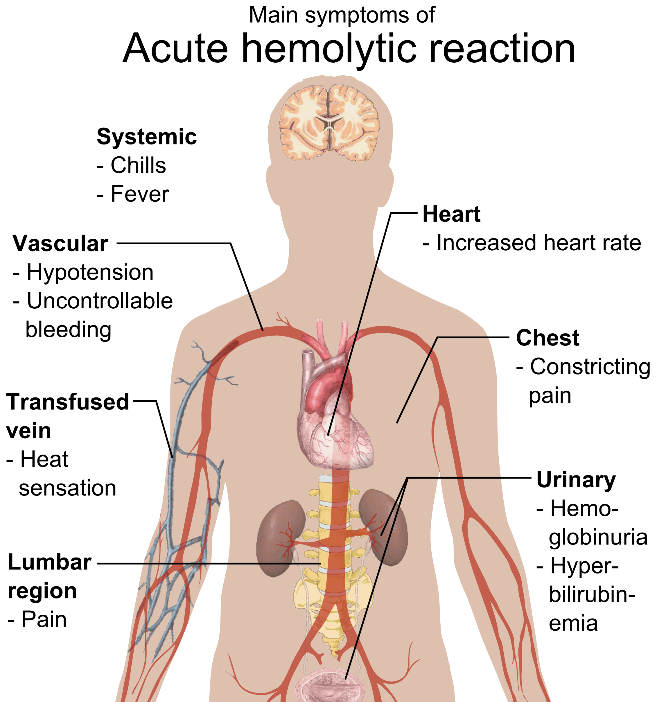 Symptômes surveillés lors d'une transfusion