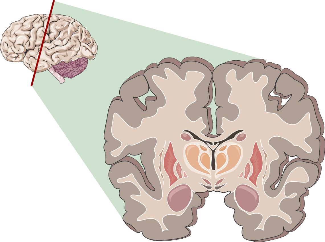 Coupe du cerveau