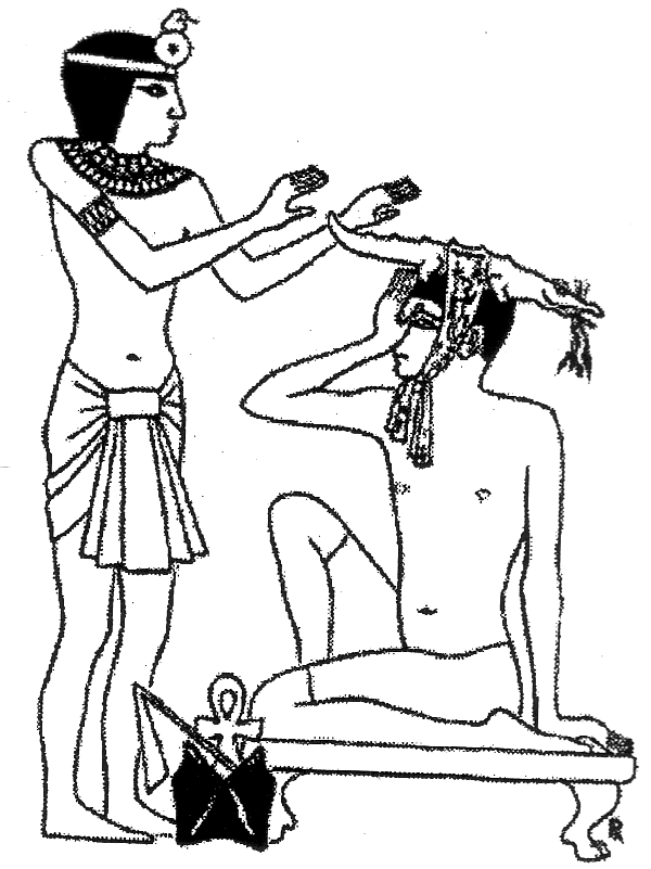 Schéma de la migraine