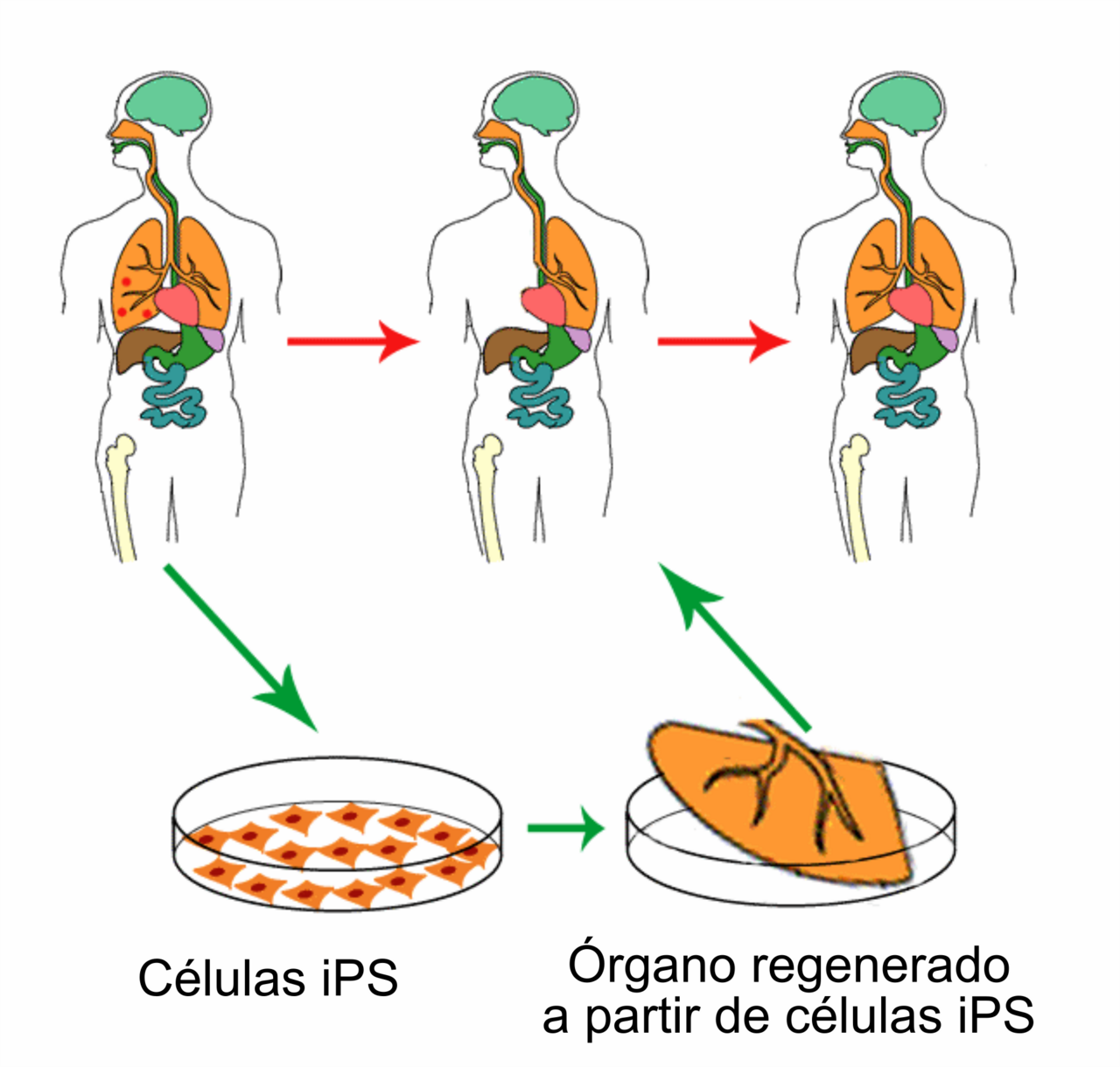 Cellules iPS
