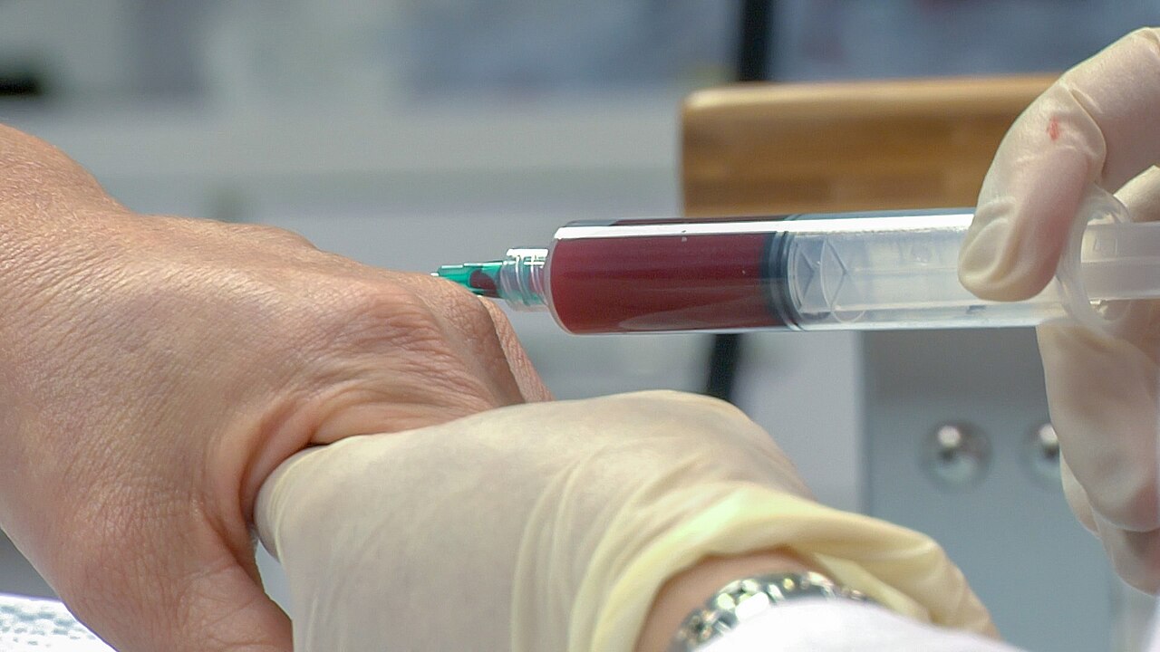 Technique d'injection en médecine régénérative