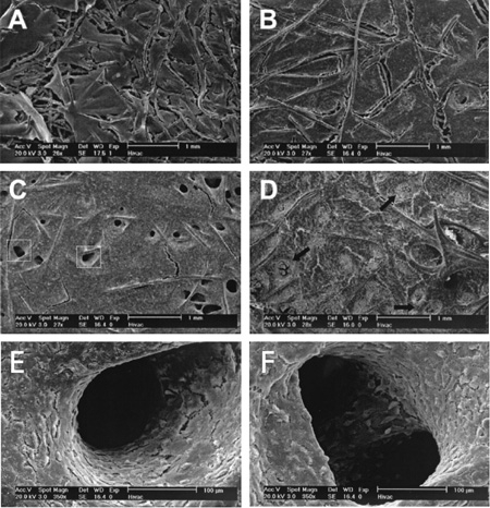 Microscopie de tissus