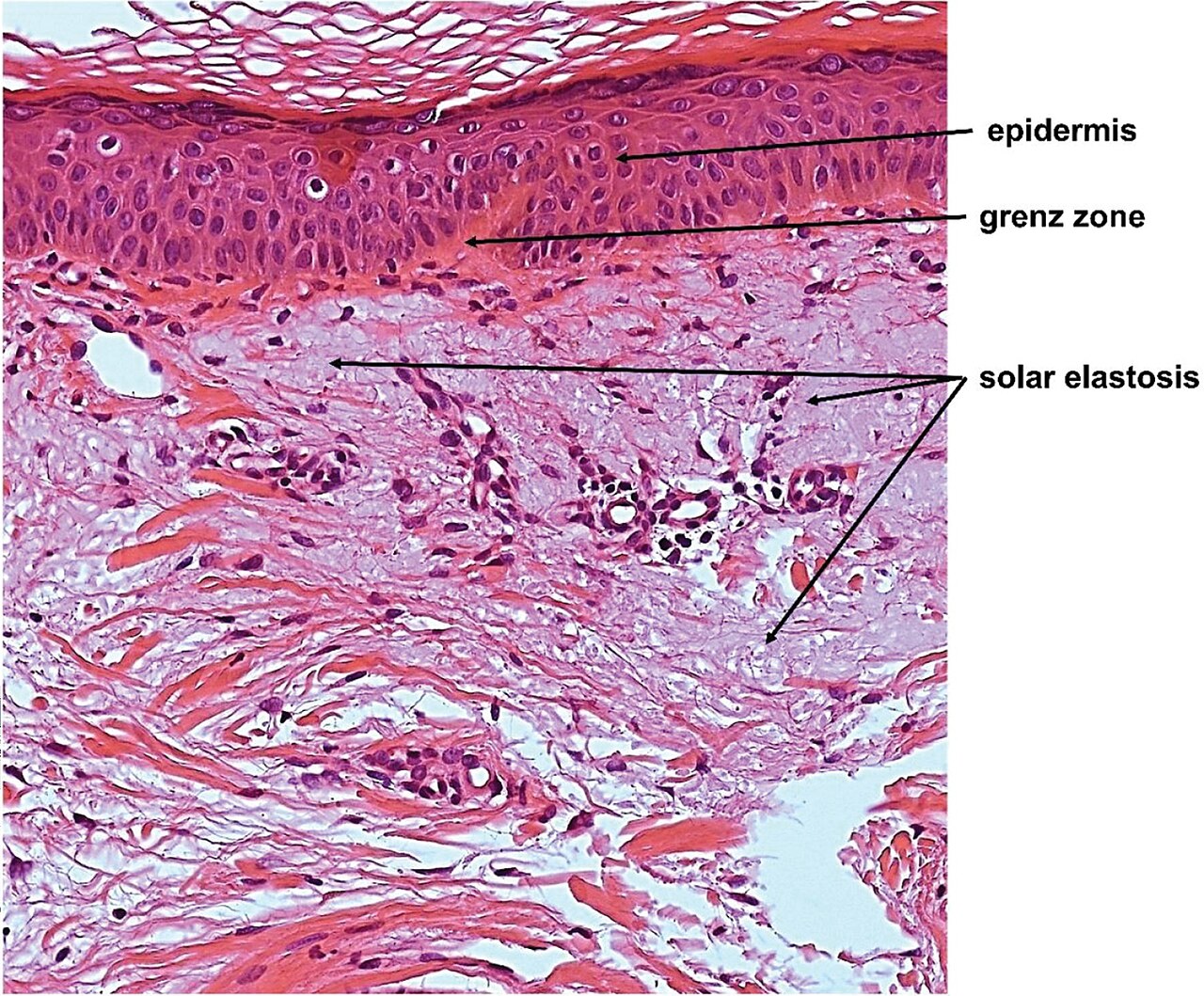 Tissu cutané en microscopie