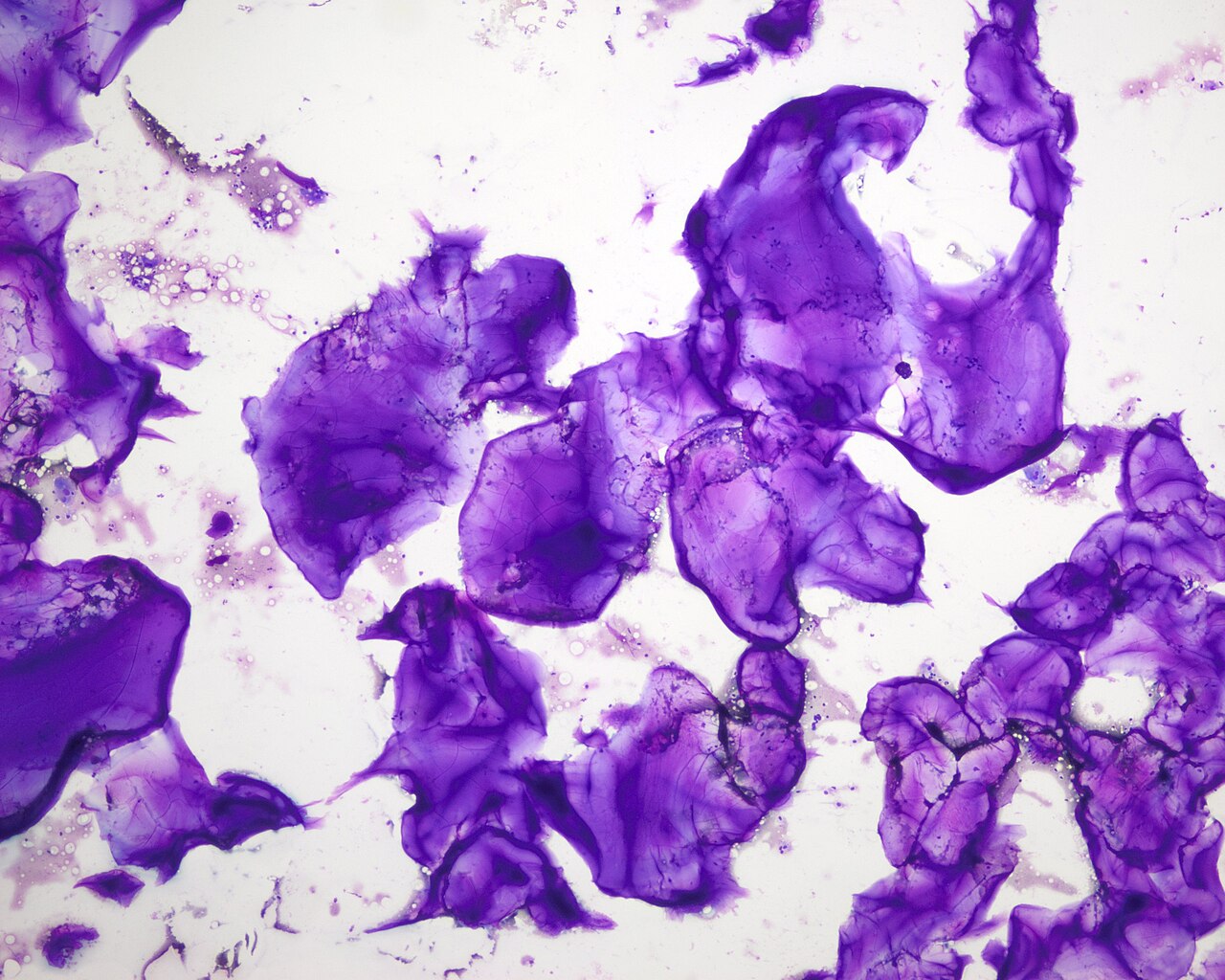 Acide hyaluronique