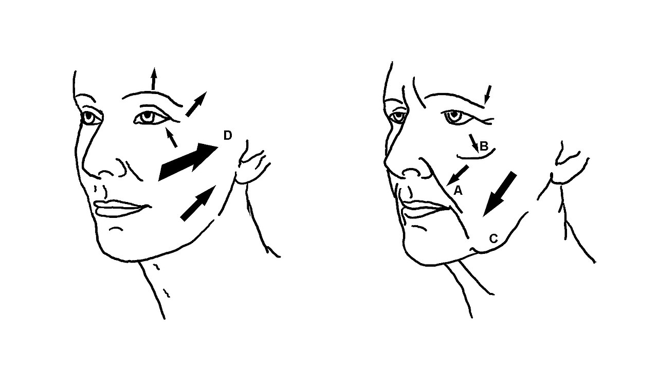 Vieillissement du visage — schéma anatomique
