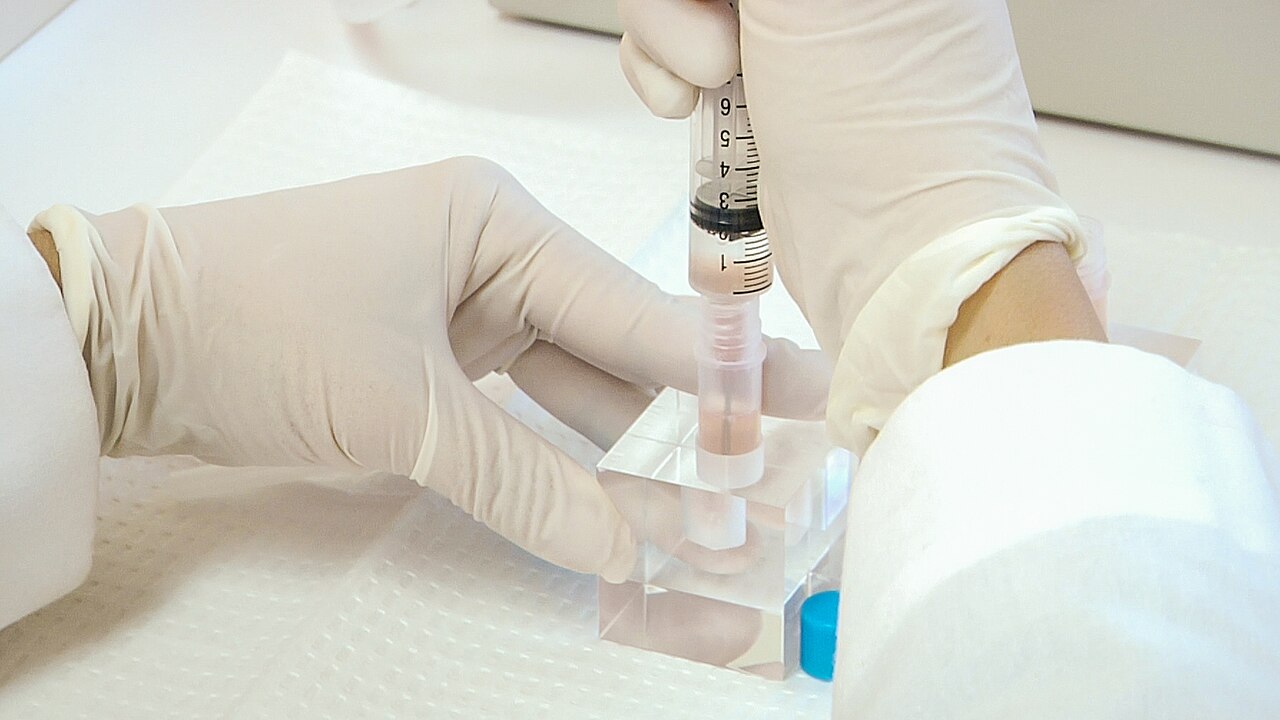 Cellules en seringue prêtes à l'injection