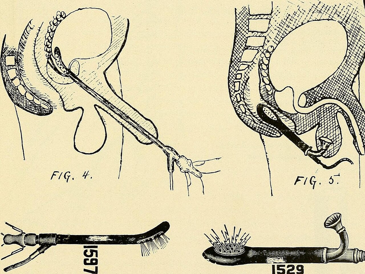 Illustration historique d'electrotherapie