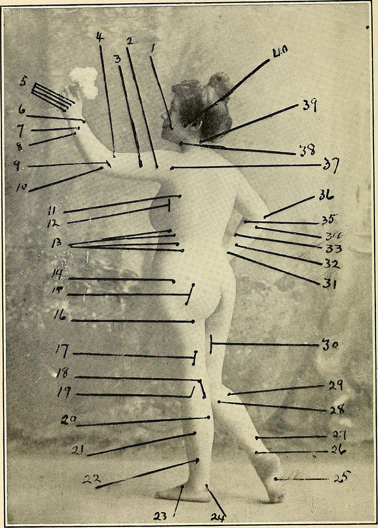 Appareil d'ondes thérapeutiques