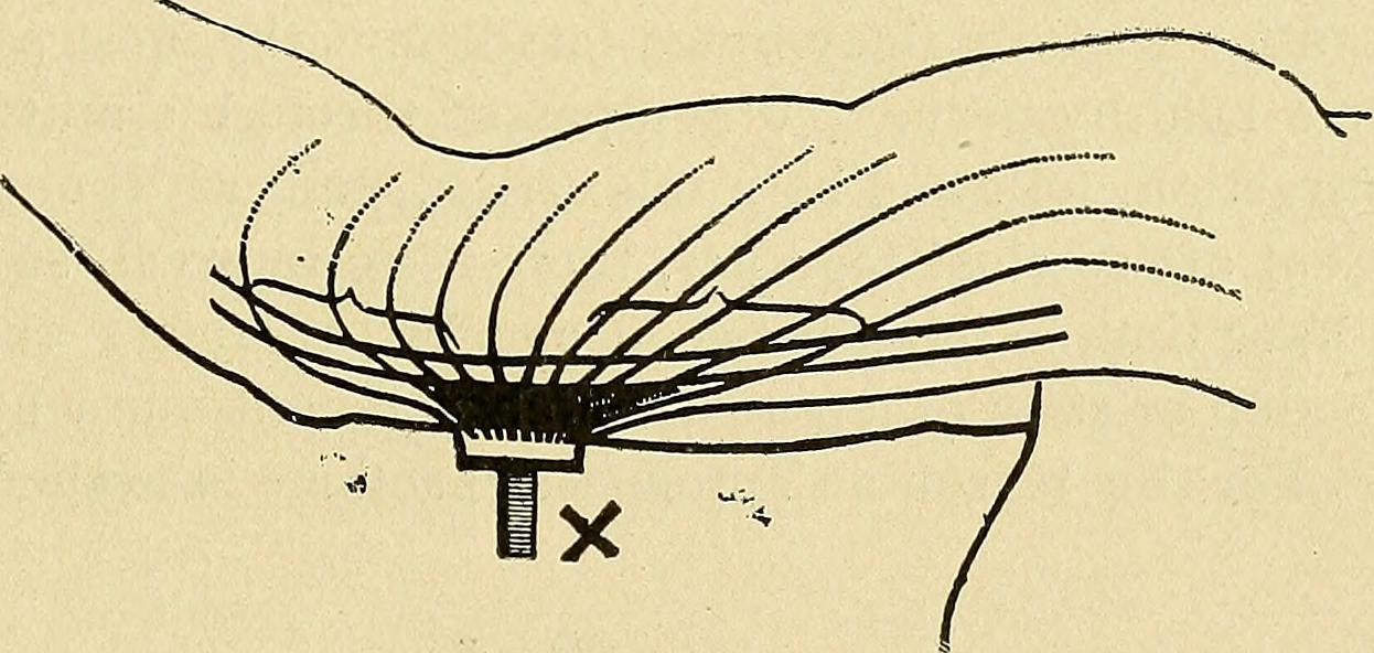 Stimulation electrique du visage