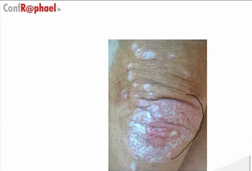 Conférence Introductive de Dermatologie