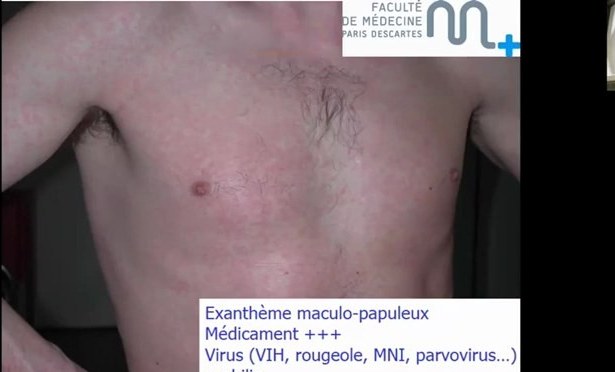 Crise Dermatologique et Raisonnement en Garde