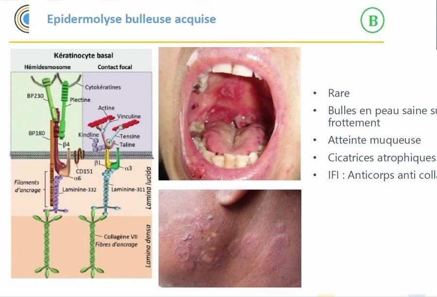 Érosions buccales et bulles cicatricielles en zone de frottement