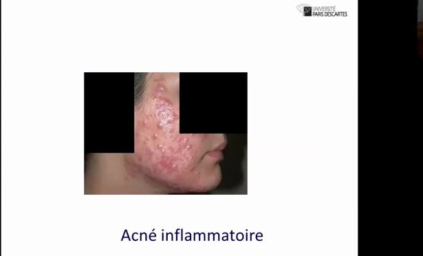 Dermatoses Faciales