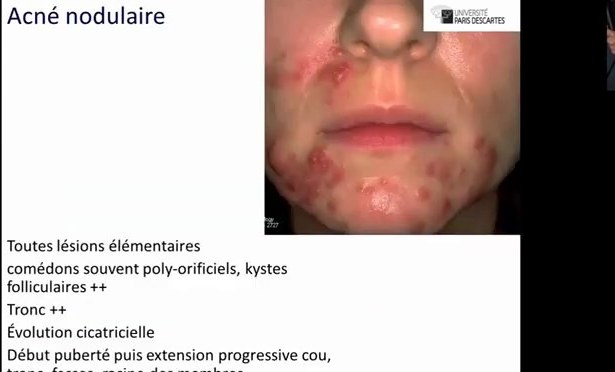 Dermatoses Faciales