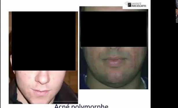 Dermatoses Faciales