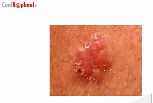 Entraînement Dermatologie - Cas et QCM