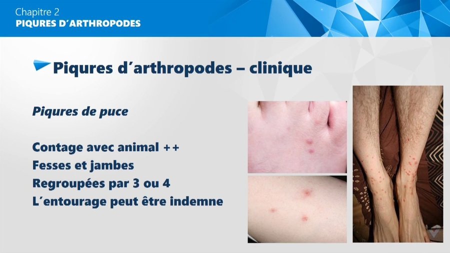Piqûres de puces groupées par 3-4 sur les jambes