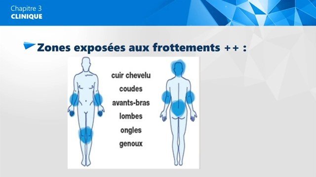 Zones cutanées les plus exposées au psoriasis